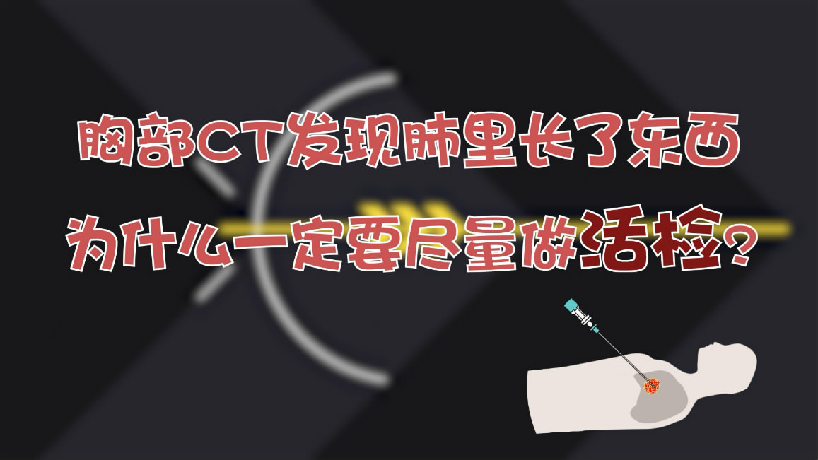 12 �ز�CT�l(f��)�F(xi��n)�����L�˖|������ʲôһ��Ҫ�M������z��